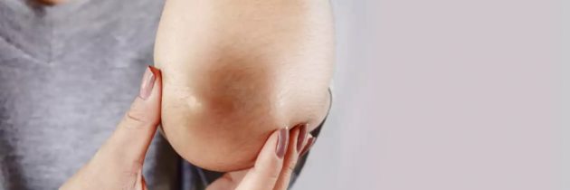 How to Get Rid of Dry Skin on Elbows: Treatment and Prevention Methods